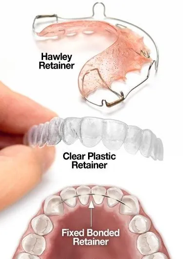 orthodontist retainers