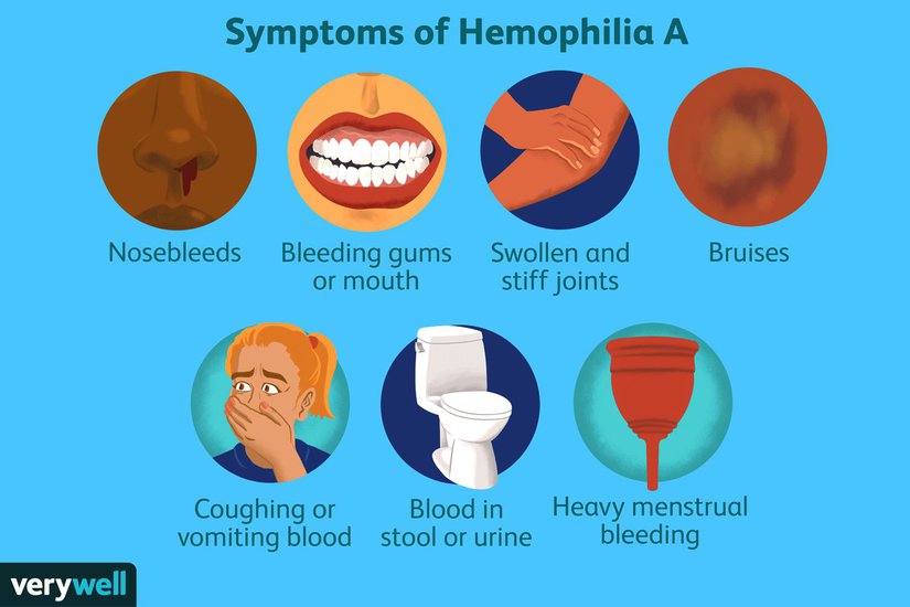 Hemophilia: Living With A Genetic Blood Disorder