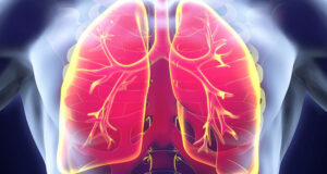 Hypertension Cause Respiratory Problems