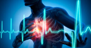 Hypertension Cause Heart Failure
