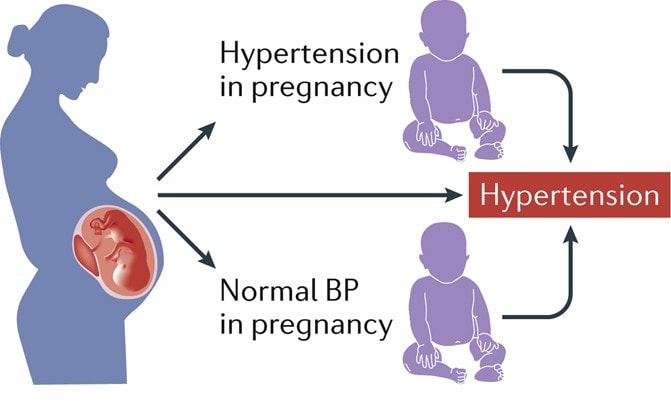 Manage Hypertension During Pregnancy
