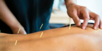 Acupuncture Provide Effective Pain Management